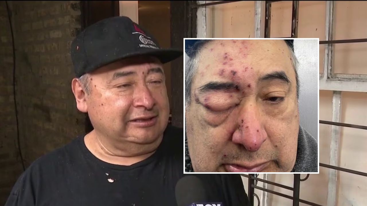Chicago Tenant Says Rats Chewed on His Face While He Slept After Months of Complaints About Infestation