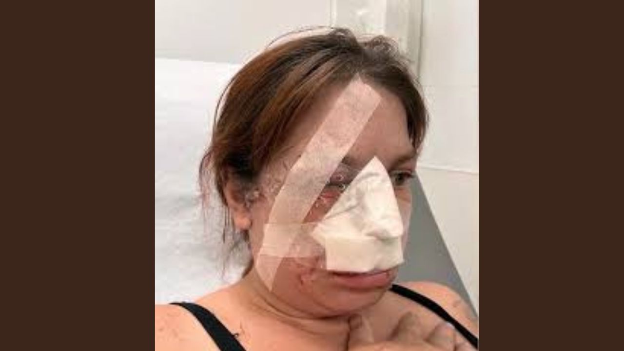 Pregnant Kansas Woman Attacked by Two Dogs While Shielding Unborn Twins, Police Say