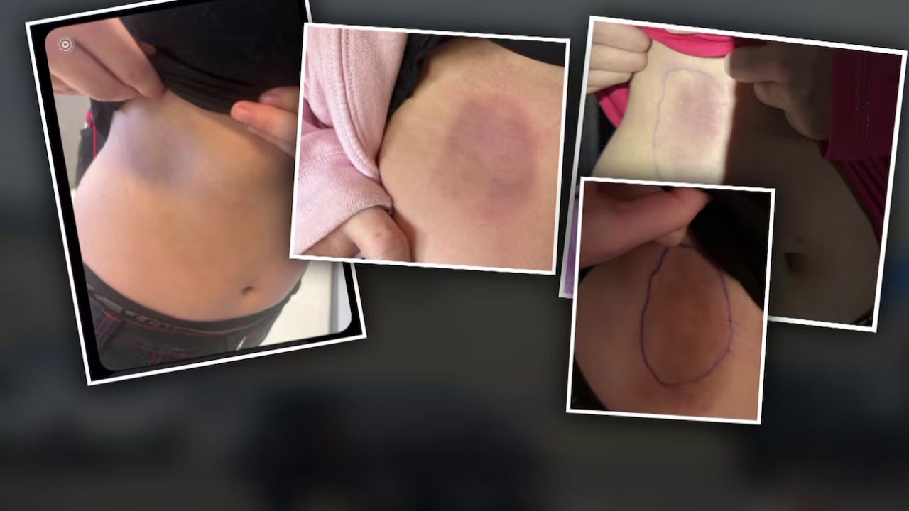 A 13-year-old is facing assault charges for throwing dodgeballs at his ex-girlfriend in gym class — and his mom says it's 'absolutely ridiculous'