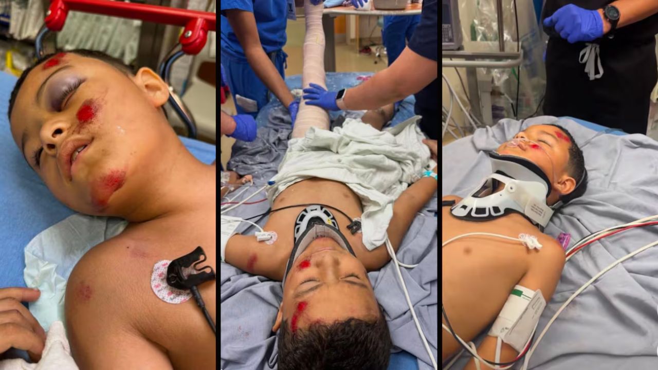 A 7-year-old boy is fighting to recover after being struck by a vehicle — his community is rallying behind him