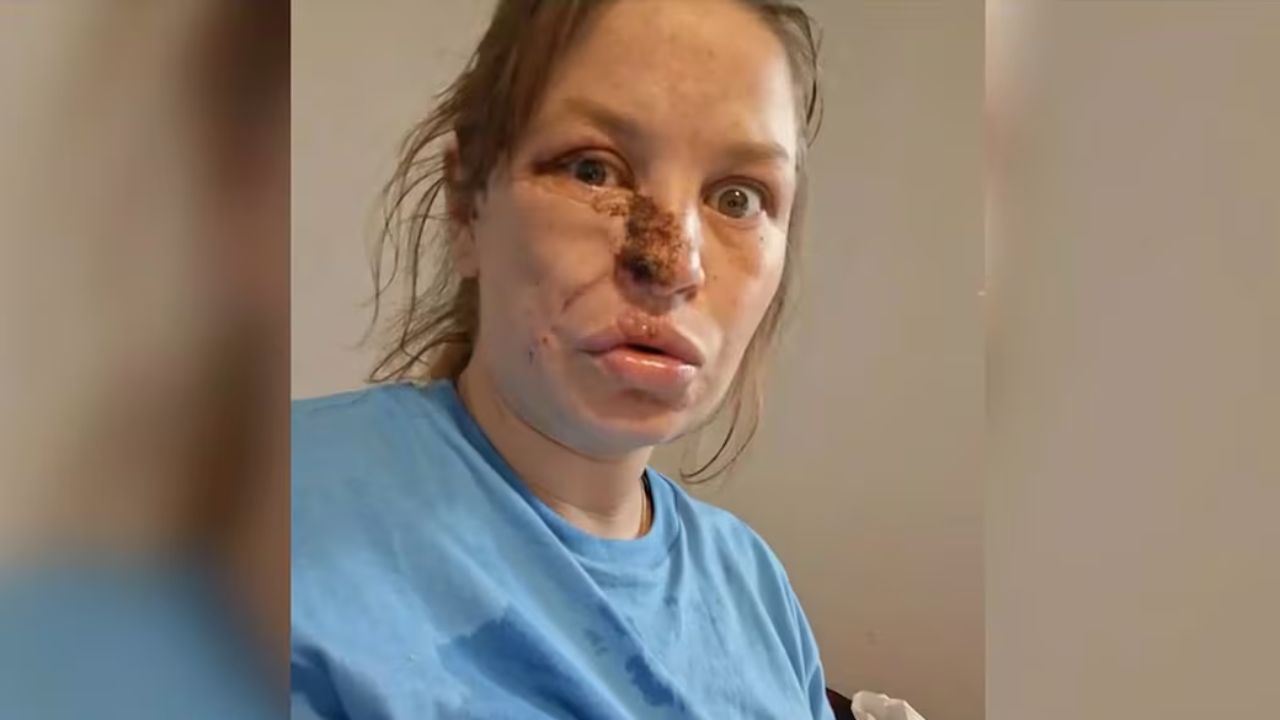 Topeka Mother Recovering After Dog Attack, Says Owner's Negligence Put Her and Unborn Twins at Risk